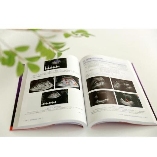 超声鉴别诊断一点通 商品图2