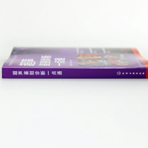 超声鉴别诊断一点通 商品图4