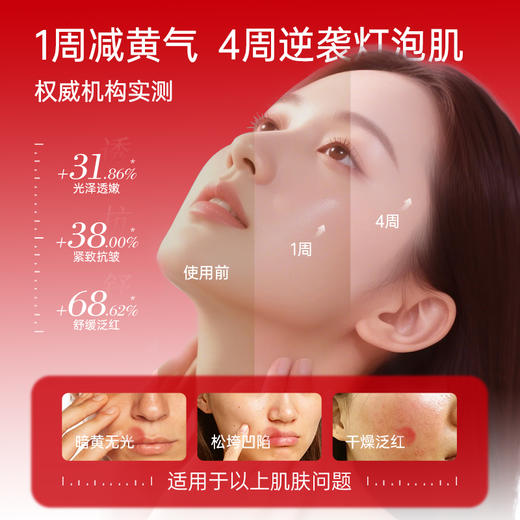 【品牌直发】斐思妮灯泡膜2.0虾青素传明酸修护贴 商品图2