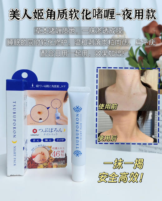 优选丨[升级版]美人姬角质粒软化啫喱系列去脂肪粒汗管粒小肉芽扁平疣温和剥落软化修护 商品图3