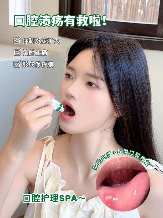 【家居百货】亲测好用!【HAIBINH口腔溃疡膏】，和口腔溃疡说拜拜，口腔溃疡膏，谁没用谁后悔。 商品图1
