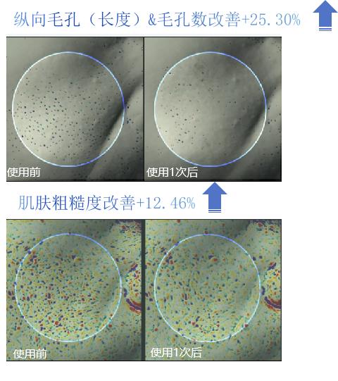 韩国ilso一苏水光微晶精华改善毛孔补水保湿，加送价值9.9的ilso随享湿敷棉片（一包含4片） 商品图2