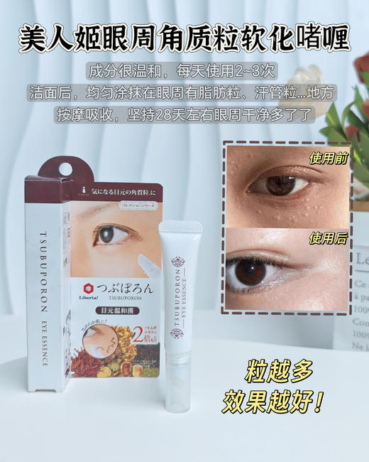 优选丨[升级版]美人姬角质粒软化啫喱系列去脂肪粒汗管粒小肉芽扁平疣温和剥落软化修护 商品图1