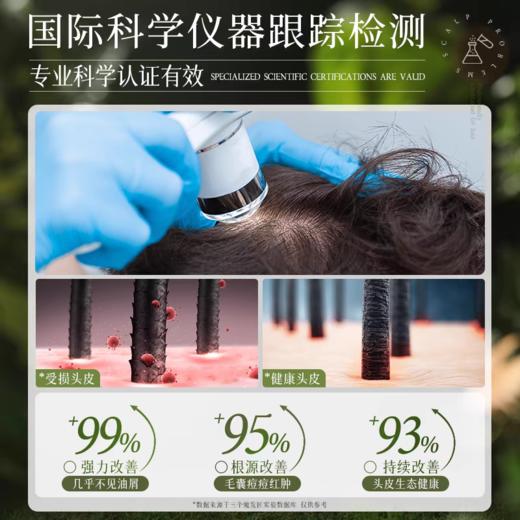 三个魔发匠二硫化硒去屑洗发水200mL【宝库优选】 商品图1