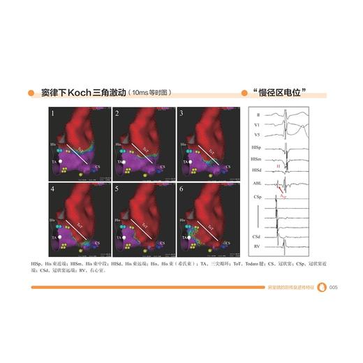 房室结的电生理特征及相关心律失常疾病/刘海雷/刘强主编/浙江大学出版社 商品图4