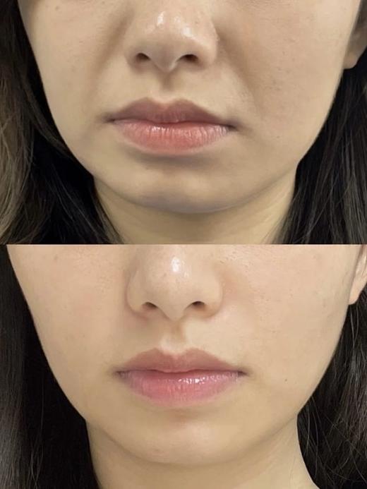 介绍链接丨到手2瓶‼️ 再赠送刮痧板一个！含国家专利！【OLORISA澳洛莉茉莉焕亮抗皱精华油】 商品图4