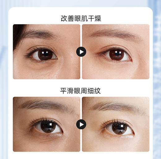 【速！拍1发2！专利加持🔥眼周焕白神器】377美白抗皱眼霜✨淡纹去袋KO黑眼圈，冰珠按摩助你重返年轻眼龄💎敏肌可用，效果看得见！ 商品图2
