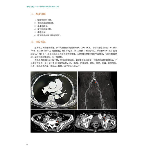 争鸣与分享——同一个病例不同的专家视角（第二辑）温妙云 马岳峰 栓塞之惑 不同寻常的哮喘和肺炎 9787117379854人民卫生出版社 商品图4