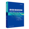 癫痫影像病例图解 商品缩略图0