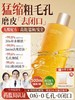 【天然舒缓 挑战0毛孔】金盏花舒缓控油爽肤水500ml#金盏花爽肤水秋冬补水保湿敷收缩毛孔控油去闭口护肤男女官方正品 商品缩略图0