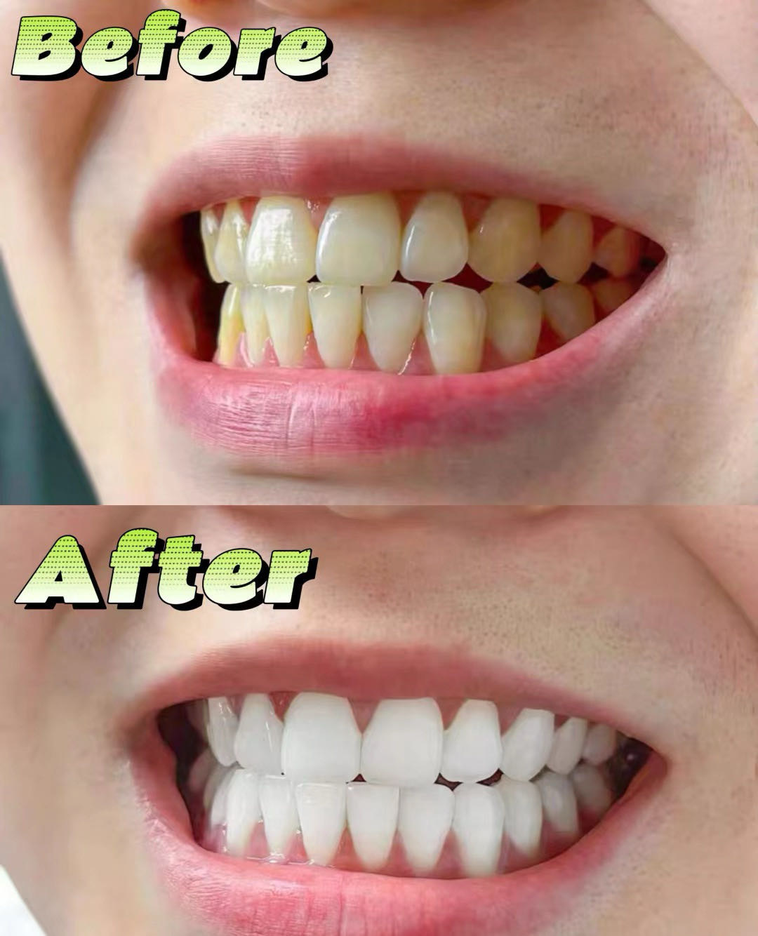 📢一般贸易品❗加拿大进口❗【Biay冰川泥盐健齿牙膏】