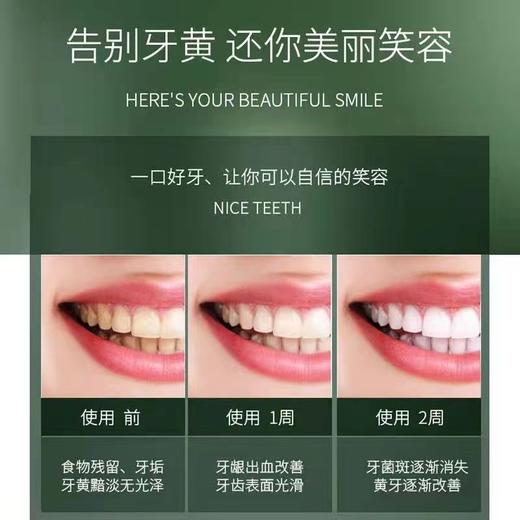 上亨（shangheng） 电动牙刷 SHZH-KQ001 商品图3