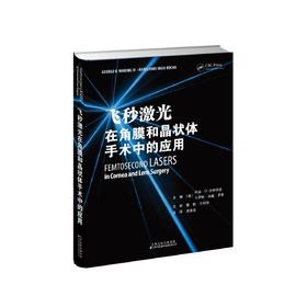 飞秒激光在角膜和晶状体手术中的应用