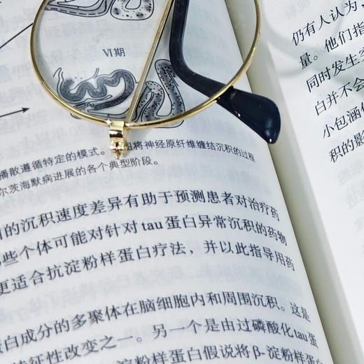 衰老之谜：解码脑老化与阿尔茨海默病 劳伦斯•J. 惠利（Lawrence J. Whalley） 著 新知文库171 三联书店旗舰店 商品图4