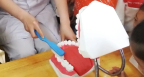  北大“韦神”患上这种牙病！从偶尔刷牙出血，到牙齿掉光仅有三步！