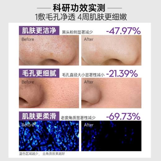 OHBT澳白紫苏泥膜油皮春夏清洁毛孔深层清洁涂抹面膜去黑头男女用 商品图1