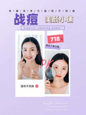 战痘卡