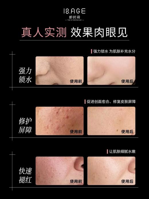 龄时间医用重组III型人源胶原蛋白敷料 商品图2