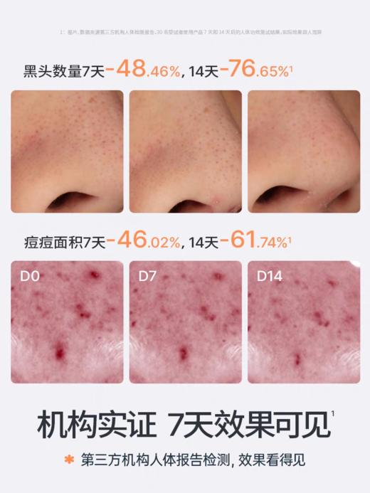 海龟爸爸控油祛痘护肤套装【宝库优选】 商品图6