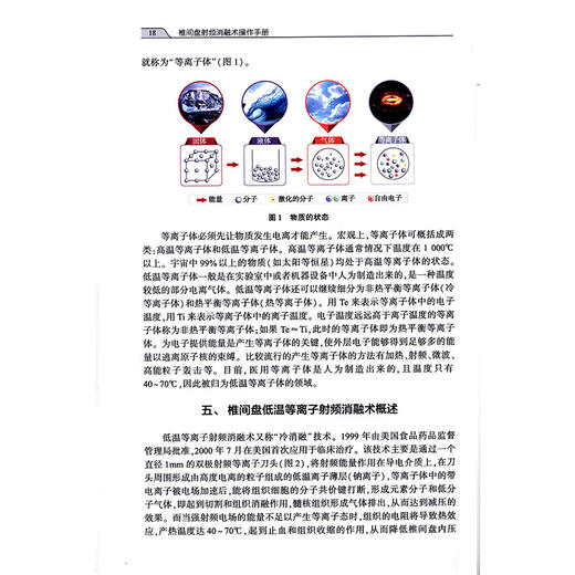 椎间盘射频消融术操作手册 孙强 主编 手术技术原理概述 椎间盘的结构与功能解剖 椎间盘退行性疾病 9787117372206人民卫生出版社 商品图4
