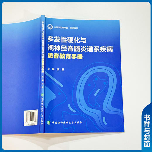 多发性硬化与视神经脊髓炎谱系疾病患者教育手册 徐雁 MS与NMODS的发病机制等治疗方法及最新的研究进展 中国协和医科大学出版社 商品图2