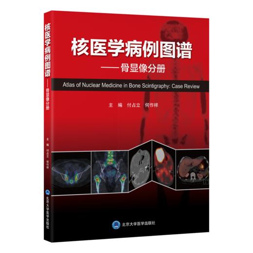 核医学病例图谱——骨显像分册   付占立　何作祥 主编   北医社 商品图0
