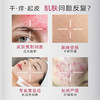 【青春期痘肌克星 】片仔癀牌舒缓凝胶 |补水保湿淡化痘印痘坑 商品缩略图3