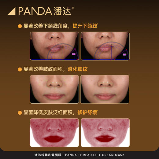 【限时专享价】潘达线雕乳霜面膜玻色因抗皱紧致下颌线提升保湿修护
 商品图9