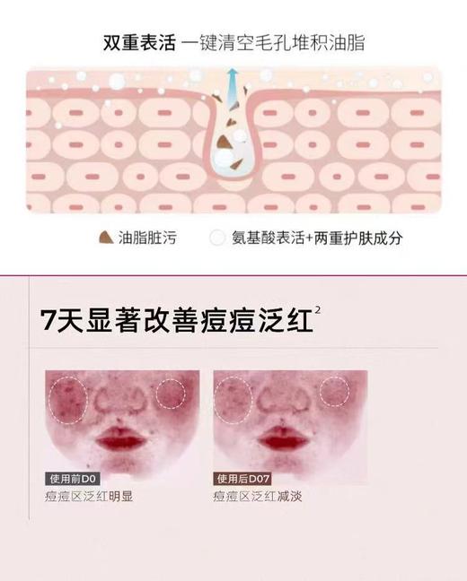 C咖氨基酸战痘清洁洁面泡沫【宝库优选】 商品图4
