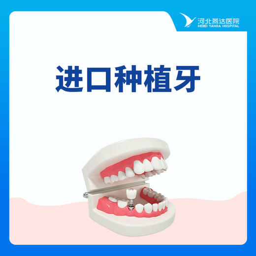 【种植牙】韩国奥齿泰进口种植牙丨四级纯钛丨单颗 商品图0