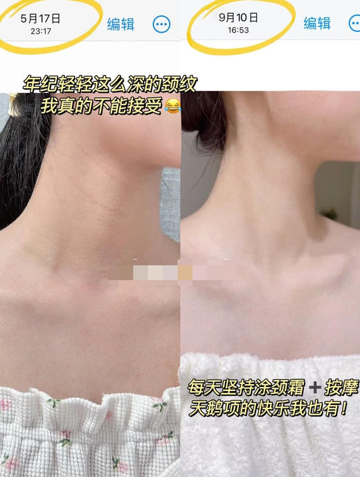 冲冲冲🔥大牛货‼️HBN双a视黄醇颈霜来了‼️一道颈纹老十岁‼️‼️‼️ 商品图5