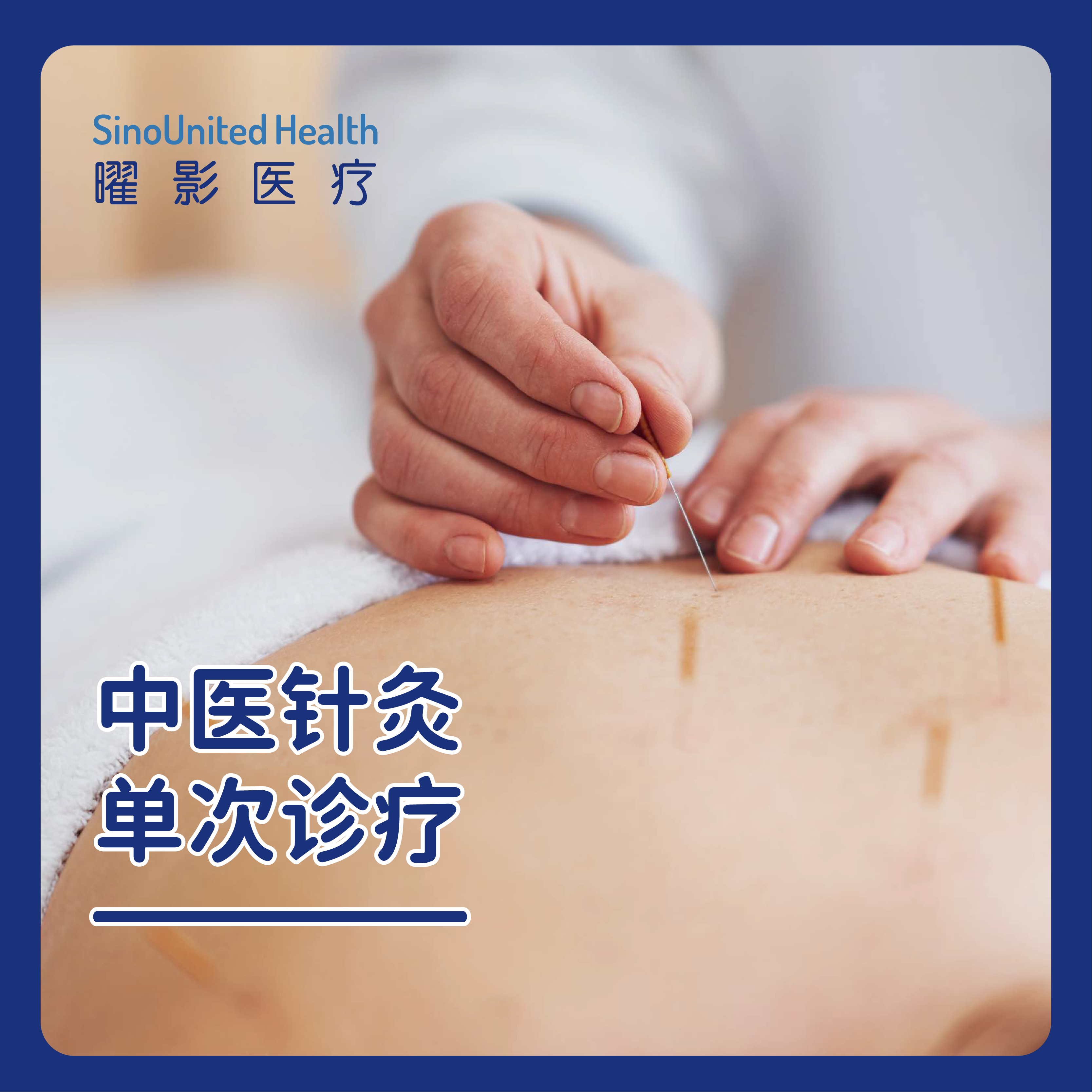 中医针灸治疗 单次体验