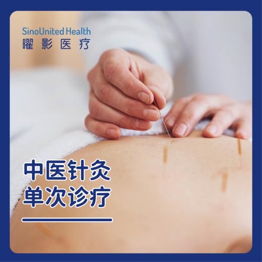 中医针灸治疗 单次体验 商品图0