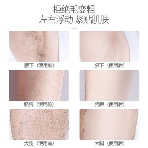 奔腾POVOS电动剃毛器女士私处刮毛刀便携脱毛器刮腋毛腿毛神器 商品图4
