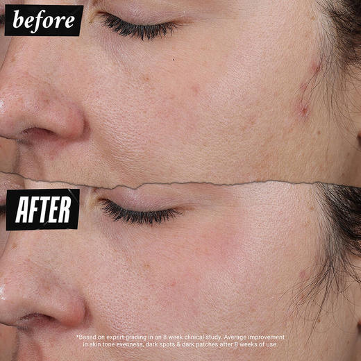 首次参加！双瓶半价=买1送1！Kiehl's  防晒淡斑精华SPF30 40ml*2 商品图2