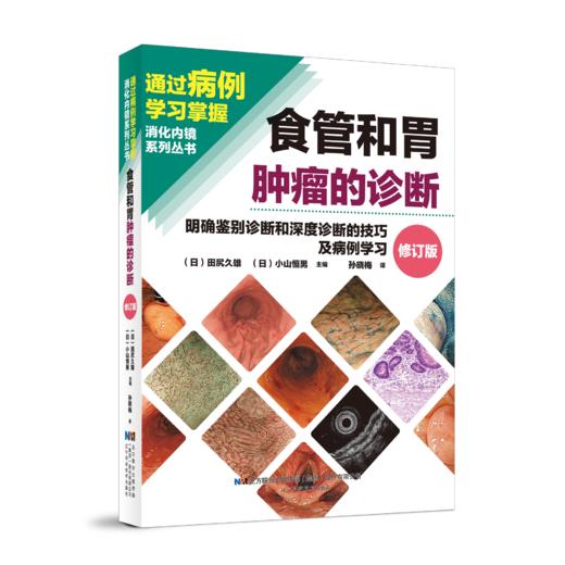 食管和胃肿瘤的诊断——明确鉴别诊断和深度诊断的技巧及病例学习（日）田尻久雄 著 内涵丰富的病例讲解 辽宁科学技术出版社 商品图1