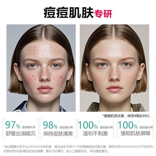 管妈妈痘痘肌抑菌功效一次性洗脸巾 400克/袋 商品图5