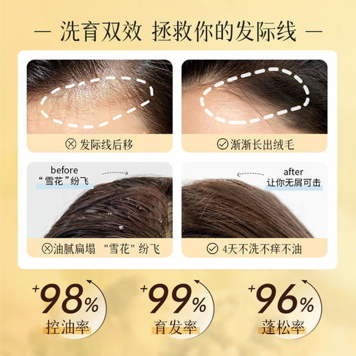 【所有会员可享】生姜洗发水30ml｜防脱固发养发,控油蓬松（订单满29元可联系客服随单寄出） 商品图1