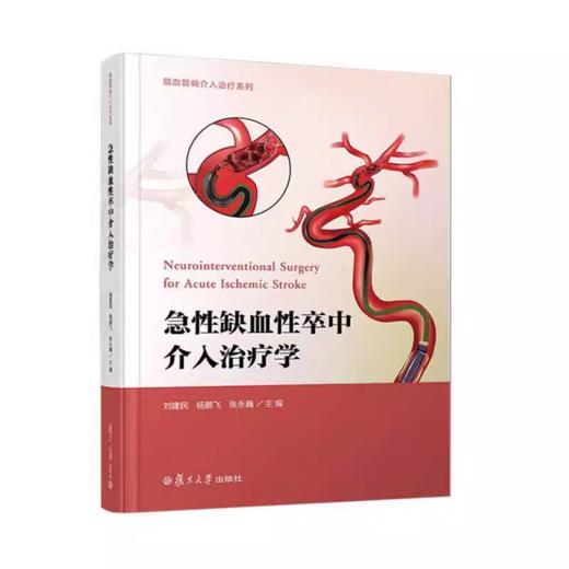 急性缺血性卒中介入治疗学 商品图0