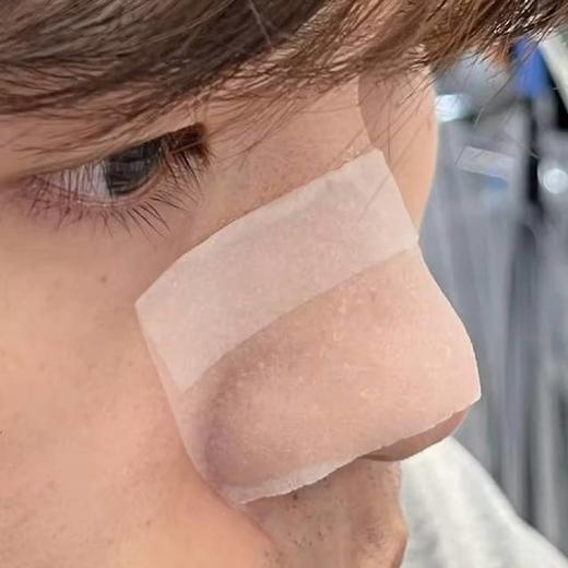 黑头拜拜~ 韩国ilso黑头水150ml+棉片50片*2 黑头导出精华液黑头导出液 去黑头粉刺毛孔清洁控油修护一苏 商品图8