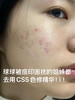 CSS希妍CUI亮肤保湿祛痘印色修精华液 商品缩略图7