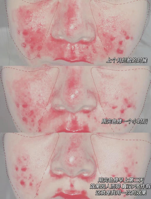CSS希妍CUI亮肤保湿祛痘印色修精华液 商品图12