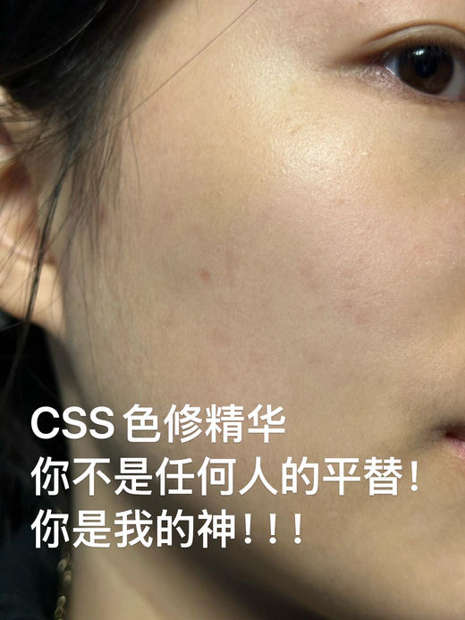 CSS希妍CUI亮肤保湿祛痘印色修精华液 商品图6