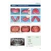 全口义齿优劣探索 成就完美的全口义齿 铃木哲也 全口义齿制作的17条原则口腔种植临床安装 辽宁科学技术出版社9787559141729 商品缩略图4