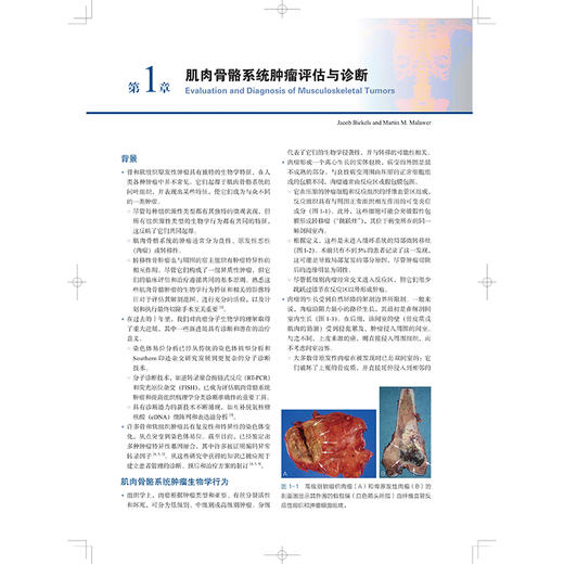 WIESEL骨科手术学·骨肿瘤外科（原著第3版）[美]马丁·M.马莱韦尔 等 适合各级临床骨科医生及研究生阅读使用 上海科学技术出版社 商品图4