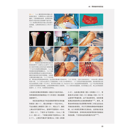 【出版社直发】口腔种植骨移植精要 第2二版 阿伦加尔格 著 骨生物学临床种植 骨采集骨增量手术移植牙科 辽宁科学技术出版社 商品图4