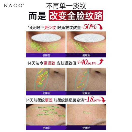 [老客专属福利]NACO玻色因抗皱紧致胶原全效抗老水乳套装水（150ml+乳120ml） 商品图4
