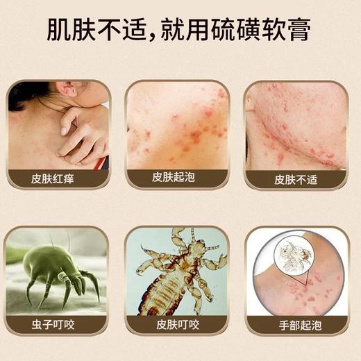 苗天使硫磺软膏圣医仁德百草祛痒保健膏20g效期20270601 商品图2