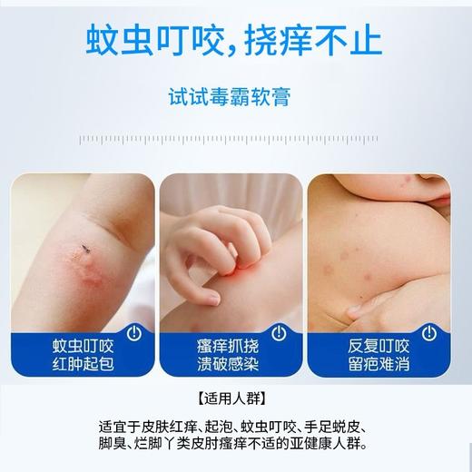 苗天使毒霸软膏圣医仁德百草祛痒保健膏20g效期20270601 商品图2
