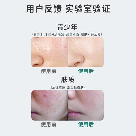 【保税仓】Himalaya喜马拉雅楝树洗面奶100ml 商品图2